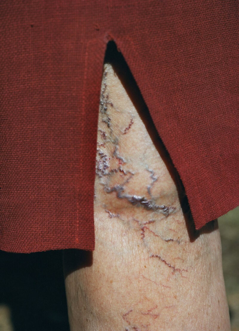 Lucile Boiron Womb C41magazine Photography 18