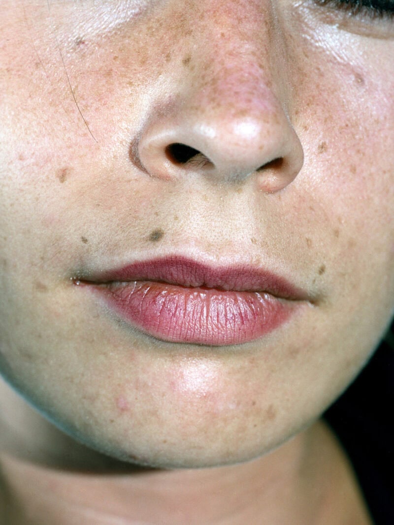 Lucile Boiron Womb C41magazine Photography 3