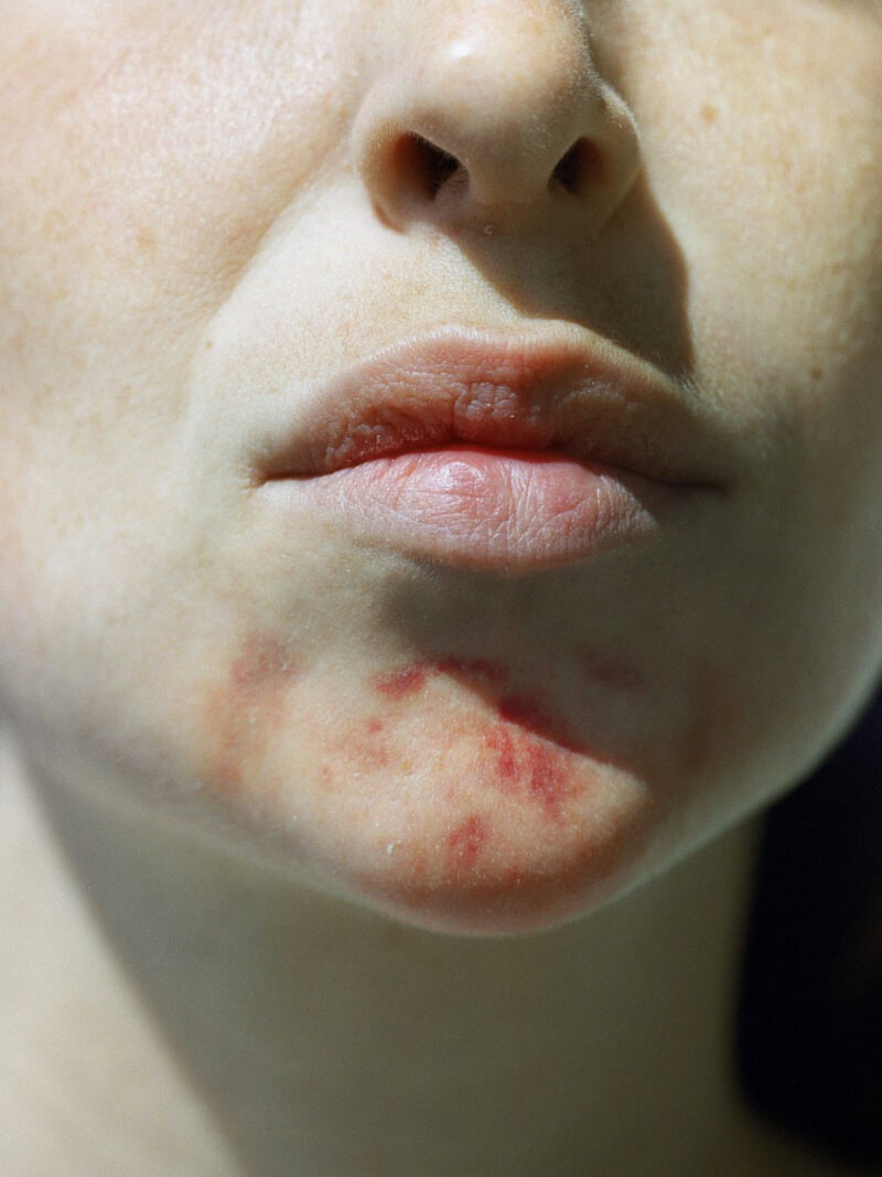 Lucile Boiron Womb C41magazine Photography 9
