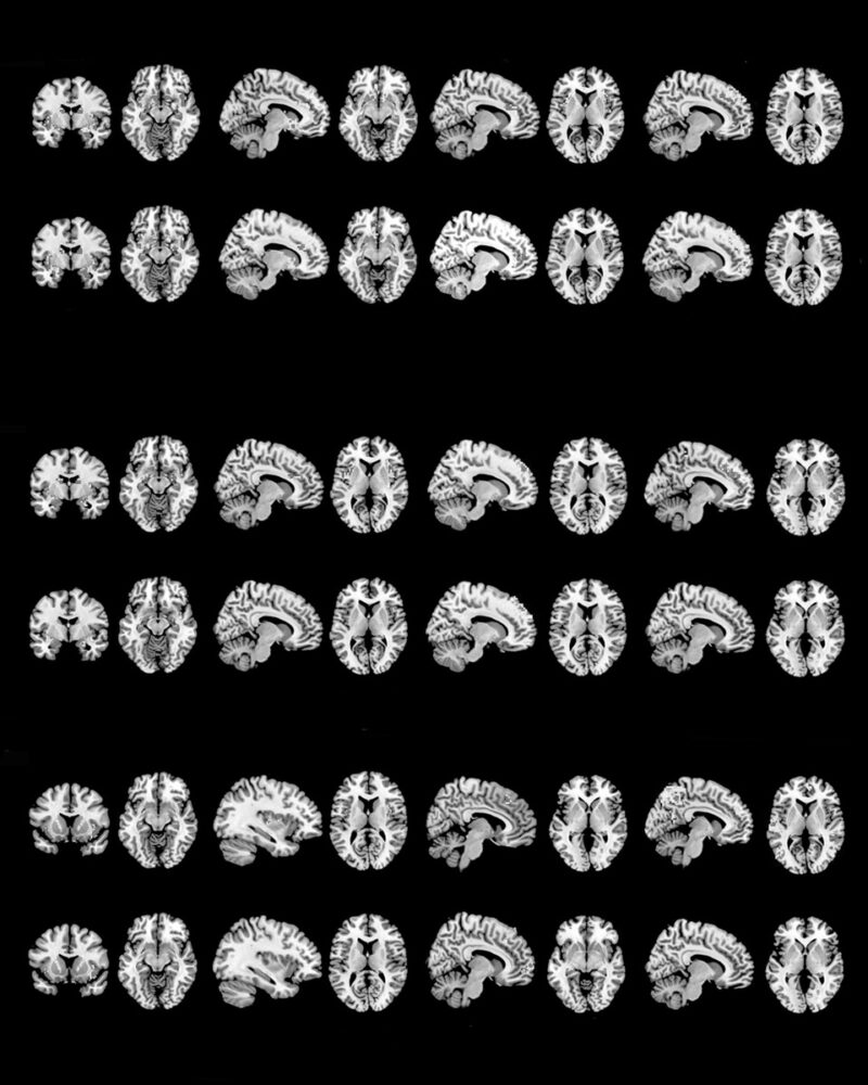 Andrea Camiolo Arianna Zanetti Neurodynamics Of A Love Relationship C41magazine Photography 14